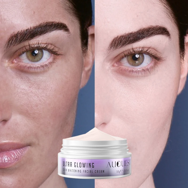 

Effective Whitening Freckle Cream Remove Melasma Dark Spot Corrector Reduce Age Spots Melanin Moisturize Brighten Face Skin Care