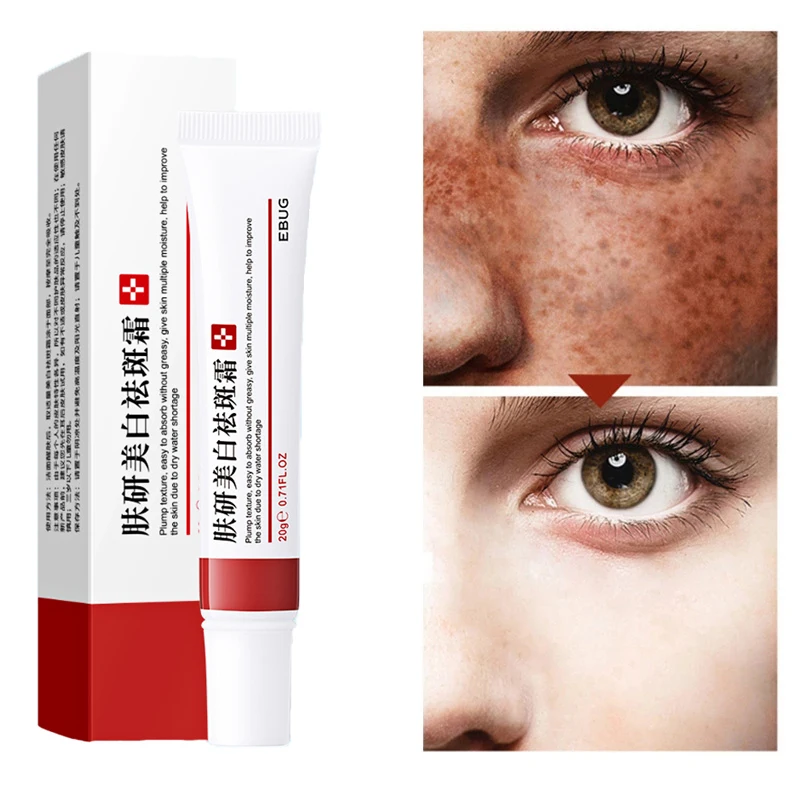5PCS Effective Freckle Cream Face Whitening Remove Melasma Acne Spot Pigment Melanin Dark Spots Pigmentation Cream Skin Care
5PCS Effective Freckle Cream Face Whitening Remove Melasma Acne Spot Pigment Melanin Dark Spots Pigmentation Cream Skin Care