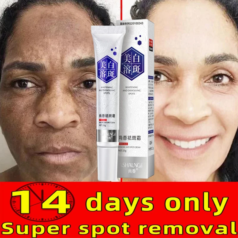 Whitening Freckle Cream Effective Remove Melasma Cream Dilute Dark Spots Melanin Moisturize Brighten Smooth Skin Care Product
Whitening Freckle Cream Effective Remove Melasma Cream Dilute Dark Spots Melanin Moisturize Brighten Smooth Skin Care Product
