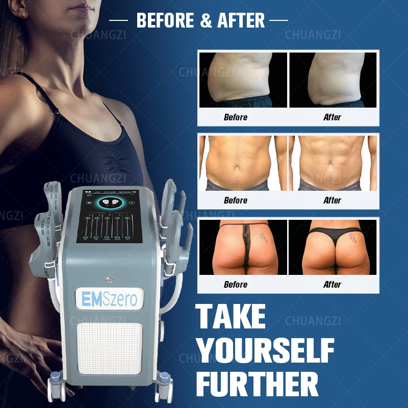 EMSzero Fat Burning DLS EMSLIM Weight-Loss Equipment Electromagnetic Ems Muscle Stimulating Body Building Machine
EMSzero Fat Burning DLS EMSLIM Weight-Loss Equipment Electromagnetic Ems Muscle Stimulating Body Building Machine