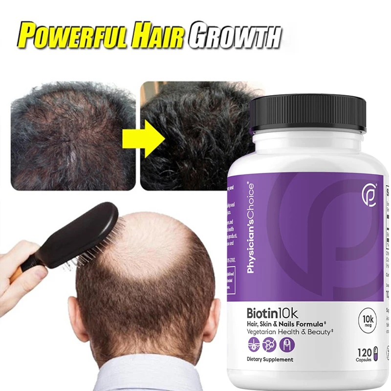 Биотин в капсулах для волос, кожи, выпадения волос ногтей, ухода за кожей головы, восстановления волосяного фолликула, подавление сексуального гормона
Биотин в капсулах для волос, кожи, выпадения волос ногтей, ухода за кожей головы, восстановления волосяного фолликула, подавление сексуального гормона