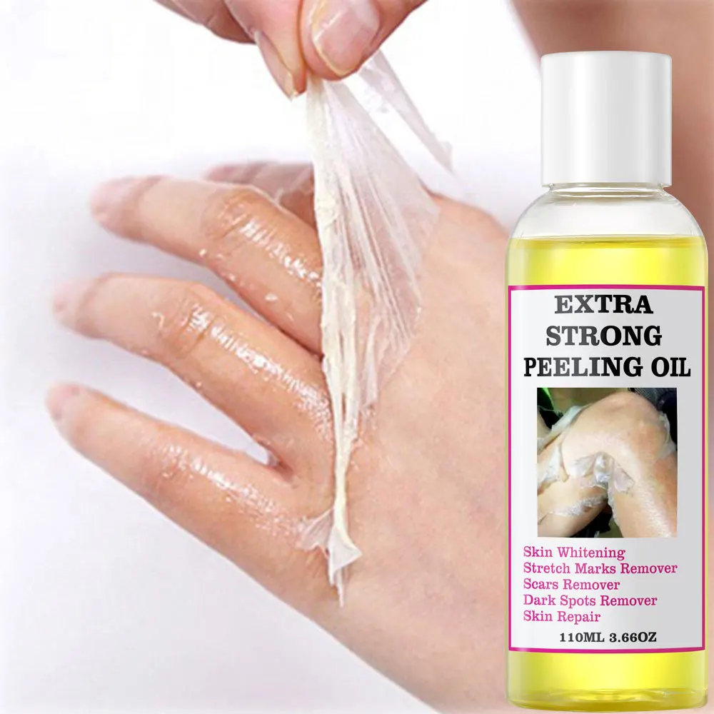 110mlBody Exfoliation Yellow Peeling Oil Bleaching Dark Skin Remove Arm Knee Legs Melanin Brightening Whitening Beauty Skin Care
110mlBody Exfoliation Yellow Peeling Oil Bleaching Dark Skin Remove Arm Knee Legs Melanin Brightening Whitening Beauty Skin Care