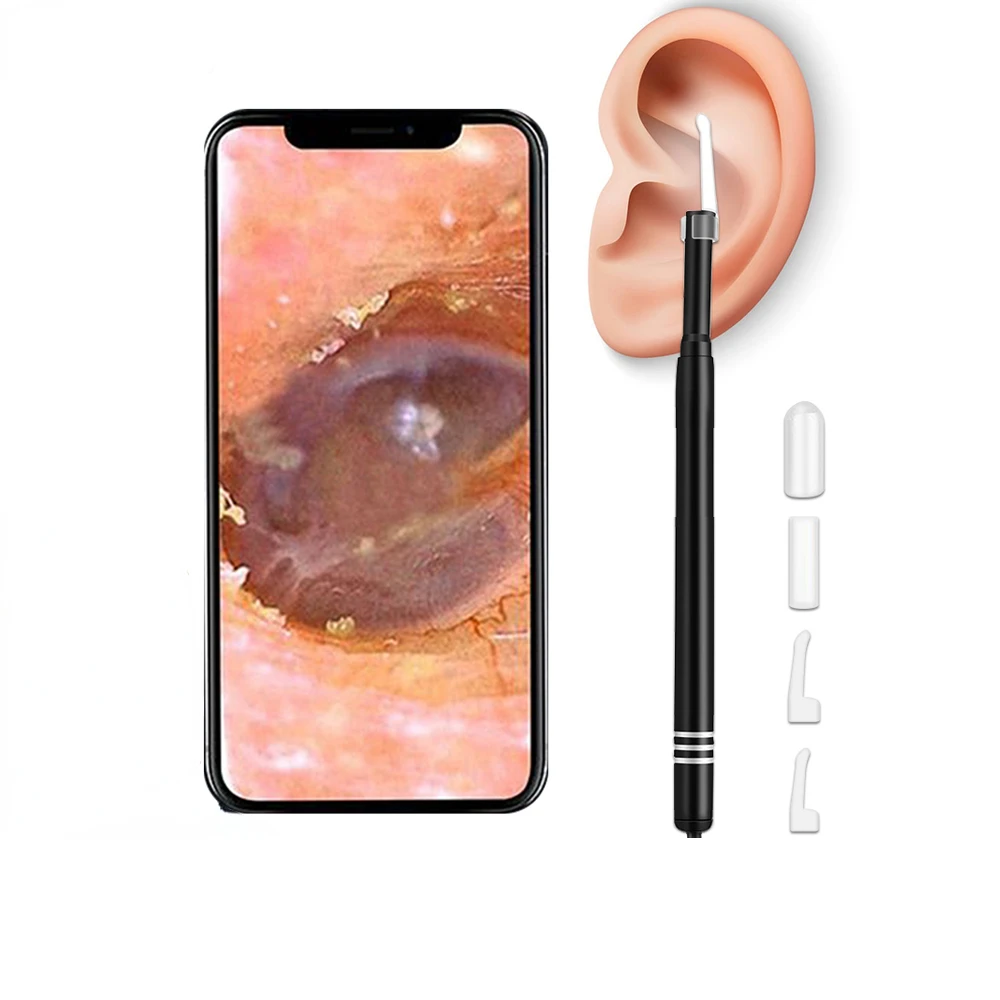 Smart Visual Ear Cleaner Ear Stick Endoscope Earpick Camera Otoscope Ear Cleaner Ear Wax Remover Ear Picker Earwax Removal Tool
Smart Visual Ear Cleaner Ear Stick Endoscope Earpick Camera Otoscope Ear Cleaner Ear Wax Remover Ear Picker Earwax Removal Tool