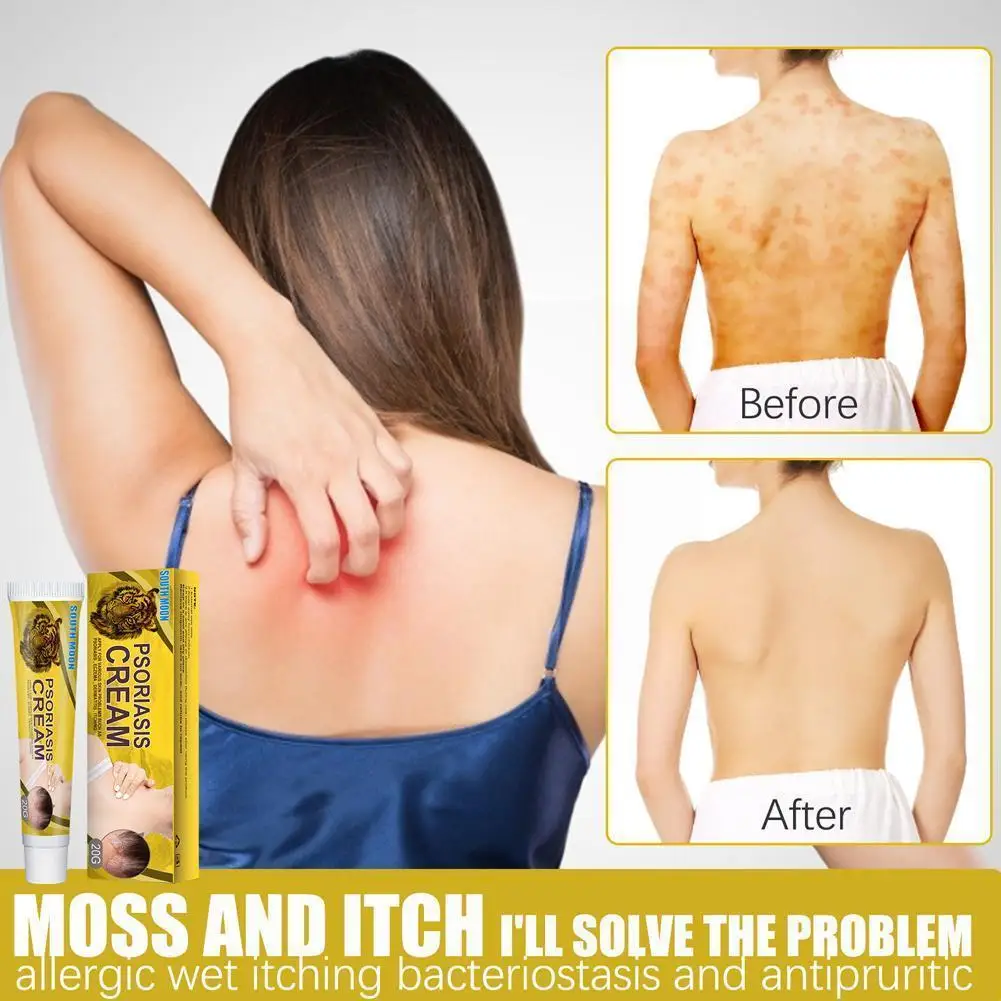 Skin Moss Removal Cream Spot Smooth Skin Moisturizer Tightening Removal Cream Skin Relaxing Sweat Relieve Wrinkle Spot Itch J4M7
Skin Moss Removal Cream Spot Smooth Skin Moisturizer Tightening Removal Cream Skin Relaxing Sweat Relieve Wrinkle Spot Itch J4M7