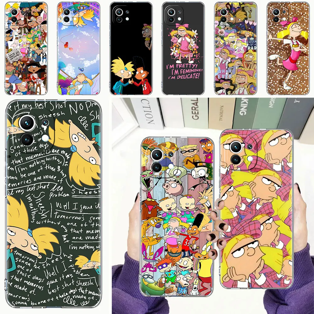 Waterproof Phone Case for Xiaomi Mi Poco X3 NFC 11 Lite 12 10T Pro M3 11T Clear Shell F3 9T 12X F1 Cover Hey Arnolds Cartoon
Waterproof Phone Case for Xiaomi Mi Poco X3 NFC 11 Lite 12 10T Pro M3 11T Clear Shell F3 9T 12X F1 Cover Hey Arnolds Cartoon