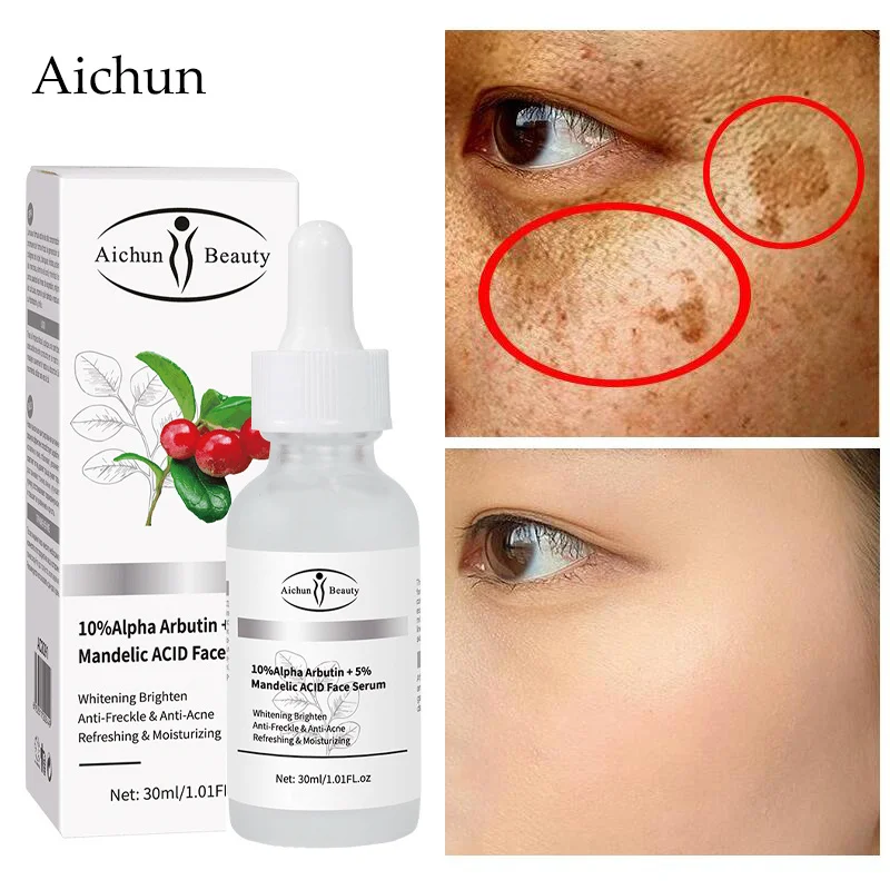 Aichun Arbutin Remove Freckle Face Serum Whitening Fade Dark Spots Fine Lines Melasma Melanin Moisturizing Brighten Facial Care
Aichun Arbutin Remove Freckle Face Serum Whitening Fade Dark Spots Fine Lines Melasma Melanin Moisturizing Brighten Facial Care