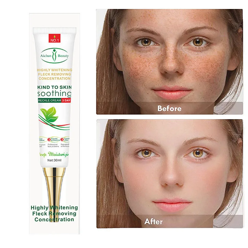Whitening Freckle Cream Fade Acne Dark Spot Scar Removal Pigment Melanin Improve Dull Anti-aging Moisturizing Brighten Skin Care
Whitening Freckle Cream Fade Acne Dark Spot Scar Removal Pigment Melanin Improve Dull Anti-aging Moisturizing Brighten Skin Care