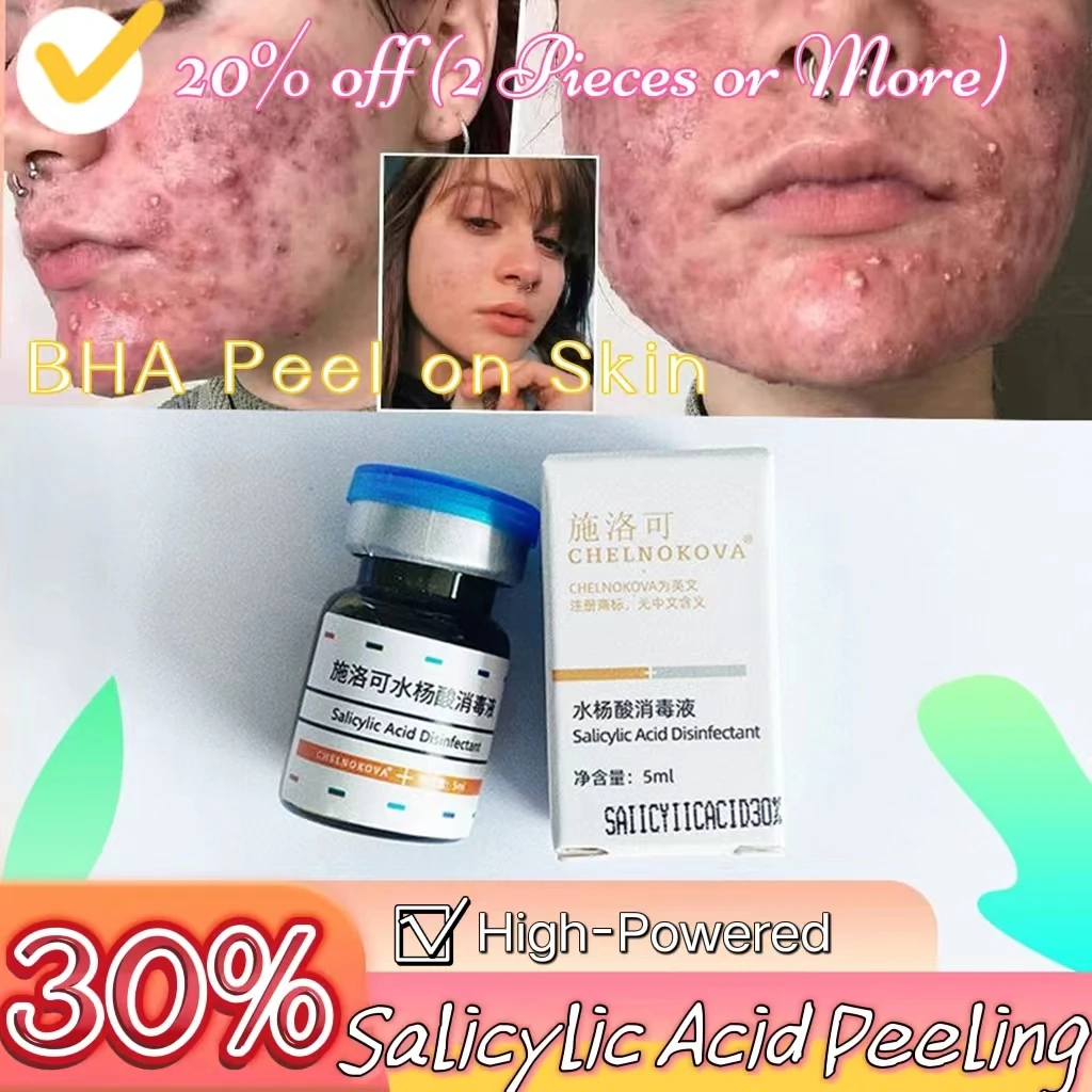 Сильная салициловая кислота, 10%, 20%, 30%, высокая концентрация, BHA-комедоны, Омолаживающая головка, прыщи, детали от прыщей
Сильная салициловая кислота, 10%, 20%, 30%, высокая концентрация, BHA-комедоны, Омолаживающая головка, прыщи, детали от прыщей
