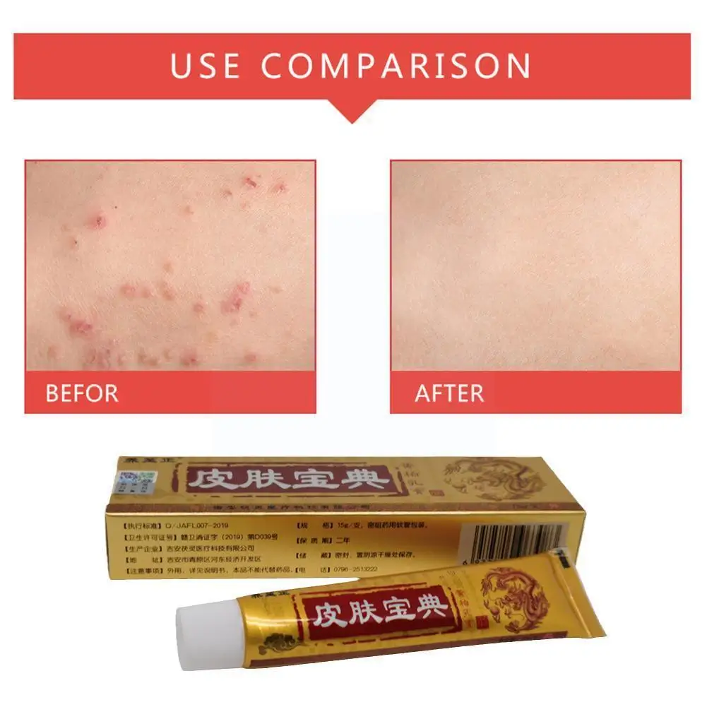 Skin Baodian Cream Ointment High Sales Bactericidal Hand Dry Ointment Antipruritic Herbal Antibacterial Cream Skin O6p1
Skin Baodian Cream Ointment High Sales Bactericidal Hand Dry Ointment Antipruritic Herbal Antibacterial Cream Skin O6p1