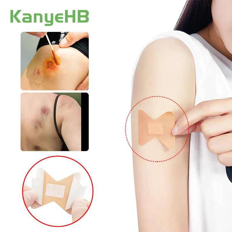 30pcs New Large Waterproof Band Aid Breathable First Aid Body Hemostasis Medical Plaster Wound Hemostasis Bandage Band-aid A1360
30pcs New Large Waterproof Band Aid Breathable First Aid Body Hemostasis Medical Plaster Wound Hemostasis Bandage Band-aid A1360