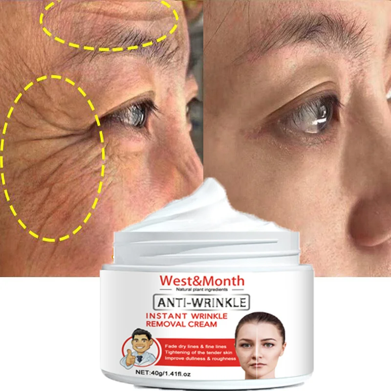 Instant Wrinkle Remover Face Cream Lifting Firming Fades Fine Lines Anti-aging Whitening Moisturizing Brighten Korean Skin Care
Instant Wrinkle Remover Face Cream Lifting Firming Fades Fine Lines Anti-aging Whitening Moisturizing Brighten Korean Skin Care