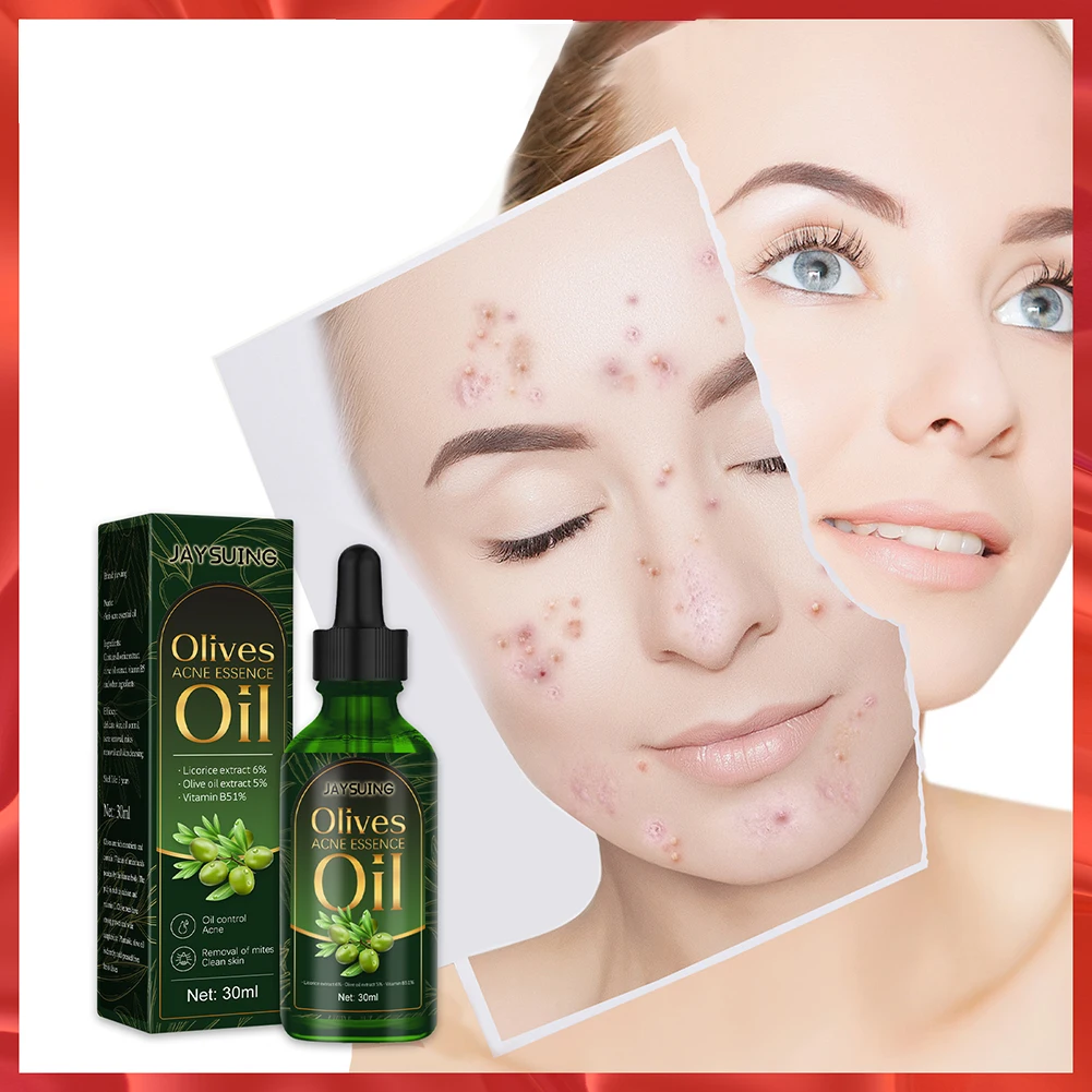 Acne Treatment Olives Oil Serum Remove Acne Spots Oil Control Shrink Pores Repair Balance Moisture and Oil Whitening Essence
Acne Treatment Olives Oil Serum Remove Acne Spots Oil Control Shrink Pores Repair Balance Moisture and Oil Whitening Essence