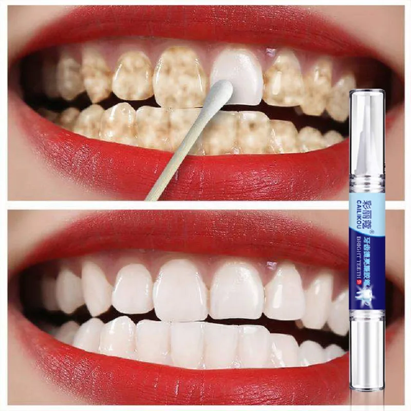 Teeth Whitening Pen Tooth Gel Whitener Bleach Remove Stains Oral Hygiene Cleaning Gel Fresh Breath Whiten Teeth Cleaning Serum
Teeth Whitening Pen Tooth Gel Whitener Bleach Remove Stains Oral Hygiene Cleaning Gel Fresh Breath Whiten Teeth Cleaning Serum