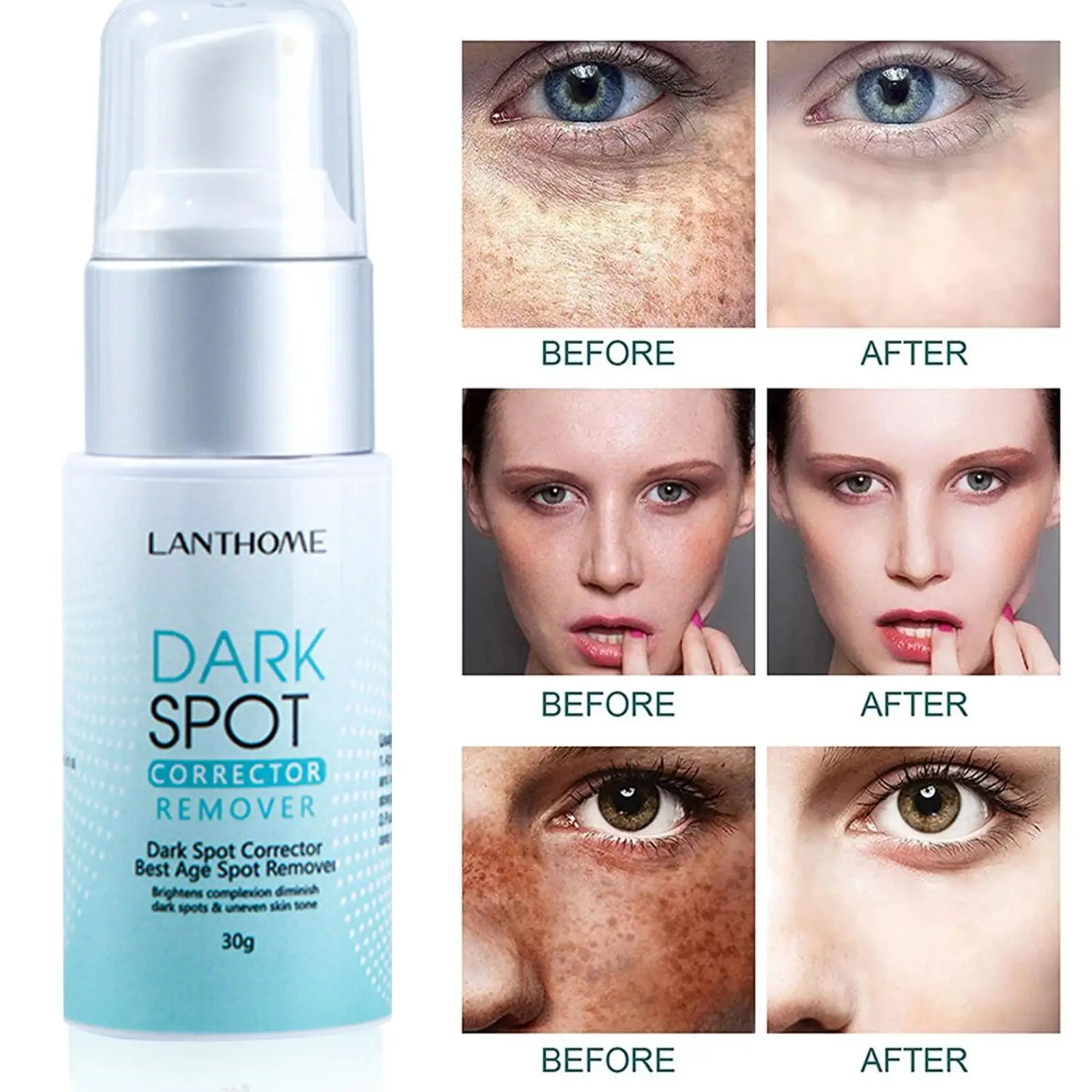 Lanthome Dark Spot Remover Corrector Age Spot Freckle Removal Emulsion Whitening Moisturizing Anti-Aging Skin Repair Skin Care
Lanthome Dark Spot Remover Corrector Age Spot Freckle Removal Emulsion Whitening Moisturizing Anti-Aging Skin Repair Skin Care