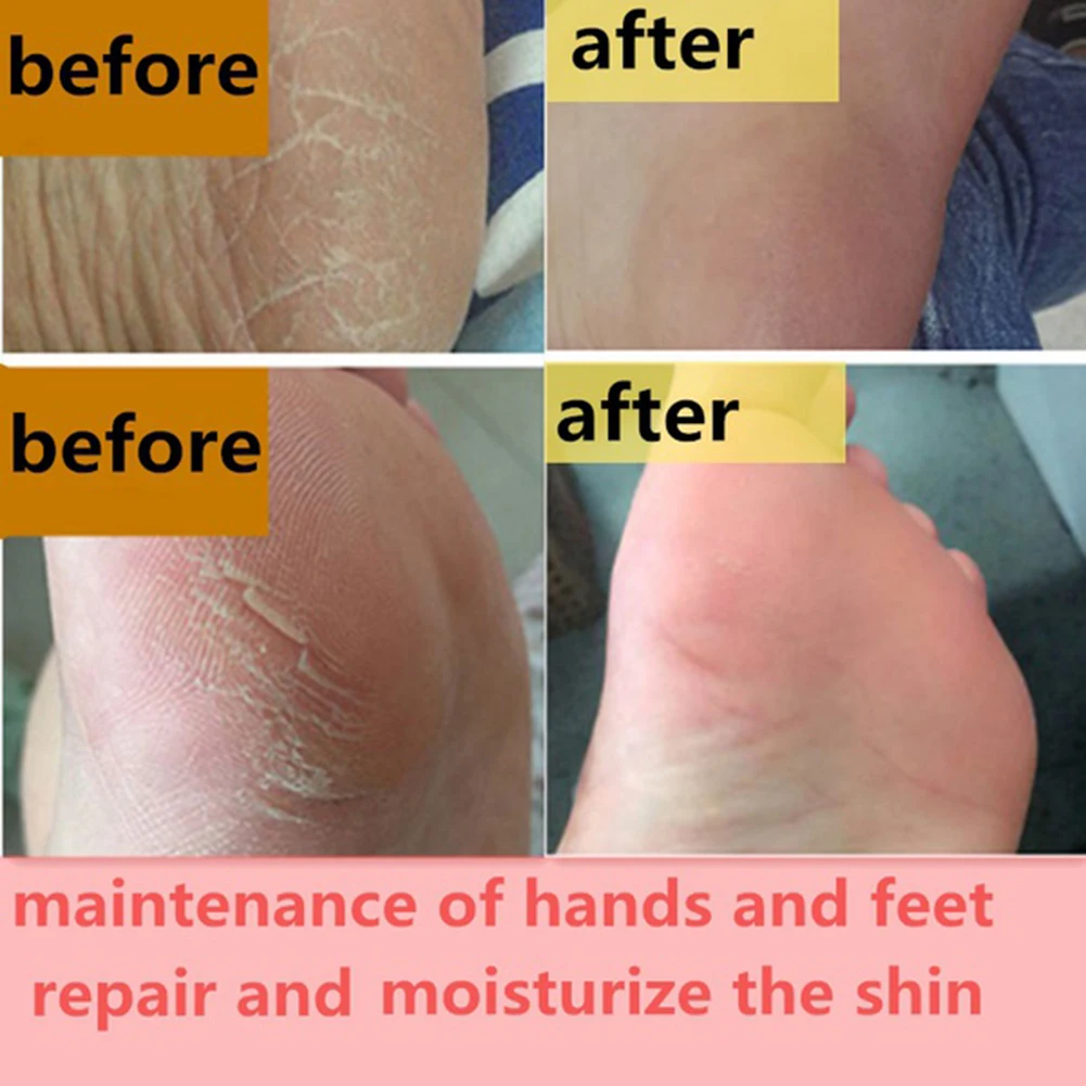 Anti Crack Foot Cream Dryness Foot Mask Heel Cracked Repair Cream Hand Moisturizing Removal Callus Dead Skin Hands Feet Care
Anti Crack Foot Cream Dryness Foot Mask Heel Cracked Repair Cream Hand Moisturizing Removal Callus Dead Skin Hands Feet Care
