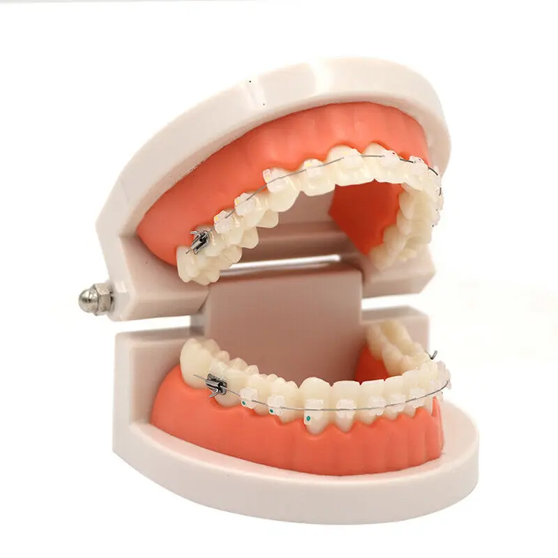 2pcs Dental Teaching Model Study Orthodontic Teeth Model With Ceramic Brackets Braces High-Quality Adult Typodont Model
2pcs Dental Teaching Model Study Orthodontic Teeth Model With Ceramic Brackets Braces High-Quality Adult Typodont Model