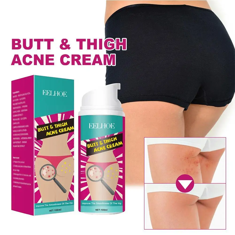 Butt Acne Treatment Thigh Dark Spot Removal Body Lotion Moisturizing Skin Cream Smooth Lightening Buttock Pores Clogging Beauty
Butt Acne Treatment Thigh Dark Spot Removal Body Lotion Moisturizing Skin Cream Smooth Lightening Buttock Pores Clogging Beauty
