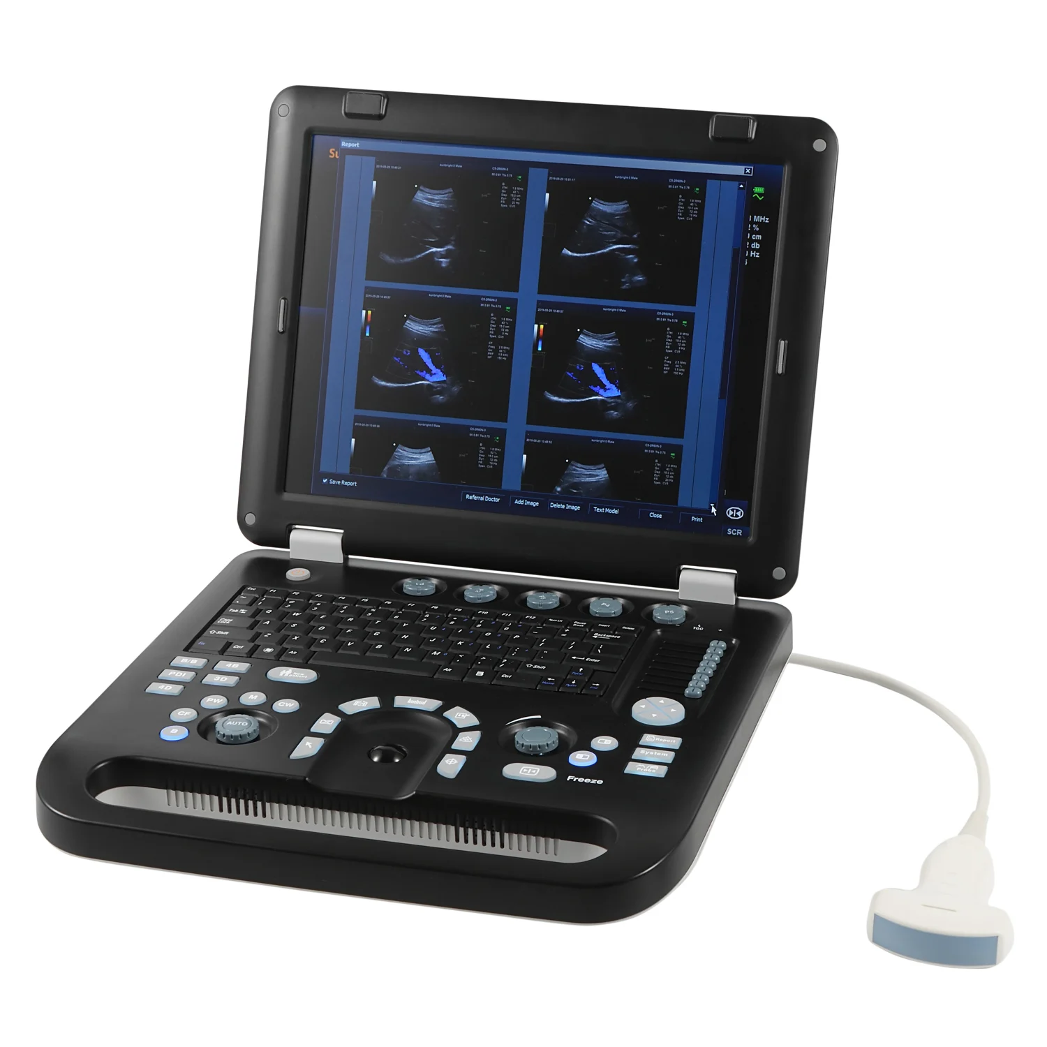Sunbright ultrasound scanner portable clinical 4d color doppler medical ultrasound instruments SUN906B 
Sunbright ultrasound scanner portable clinical 4d color doppler medical ultrasound instruments SUN906B