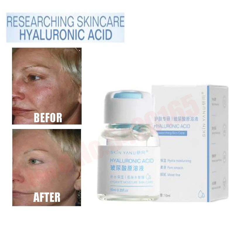 Meostherapy Hyaluronic Acid Ampoule Fulid Essence 10ml Micro Needling Dermapen Instensive Care Face Serum 10ml
Meostherapy Hyaluronic Acid Ampoule Fulid Essence 10ml Micro Needling Dermapen Instensive Care Face Serum 10ml