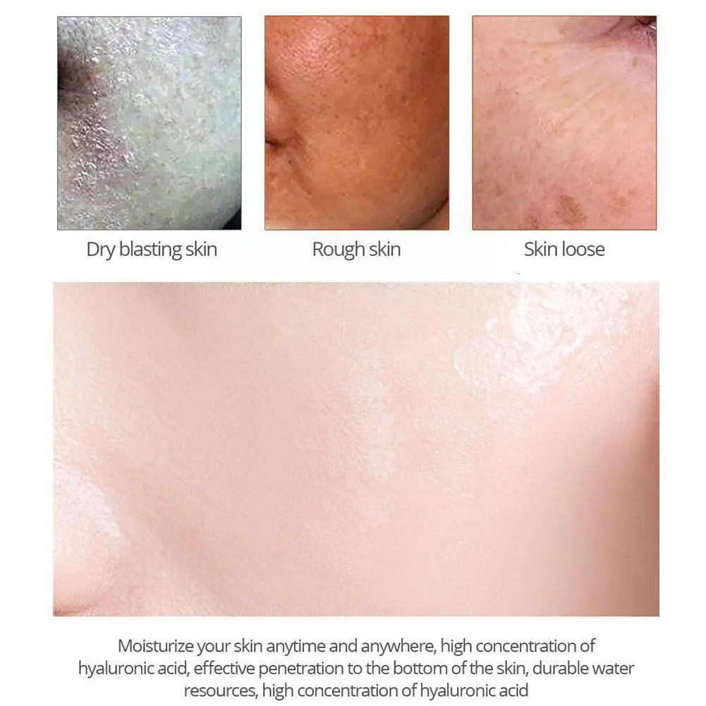 Эффективное искусственное средство 30 г для удаления мелазмы, пигментационных пятен, темного геля, меланина, увлажняющего эффекта от акне, ... 
Эффективное искусственное средство 30 г для удаления мелазмы, пигментационных пятен, темного геля, меланина, увлажняющего эффекта от акне, ...