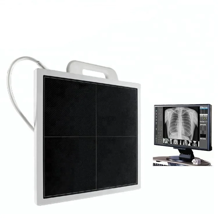 YSFPD1717M High Resolution Excellent Images Portable Wireless X-Ray Detector Digital Flat Panel Detector
YSFPD1717M High Resolution Excellent Images Portable Wireless X-Ray Detector Digital Flat Panel Detector