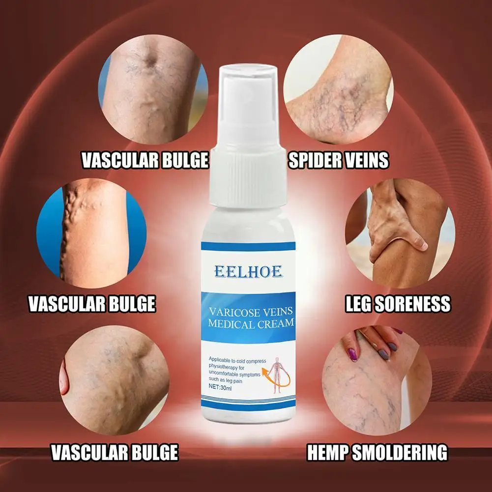 30g Varicose Vein Soothing Spray Veins Treatment Spray Itching Solution Natural Acid Leg Leg Earthworm Cure On Lumps Bad Bi C5u5
30g Varicose Vein Soothing Spray Veins Treatment Spray Itching Solution Natural Acid Leg Leg Earthworm Cure On Lumps Bad Bi C5u5