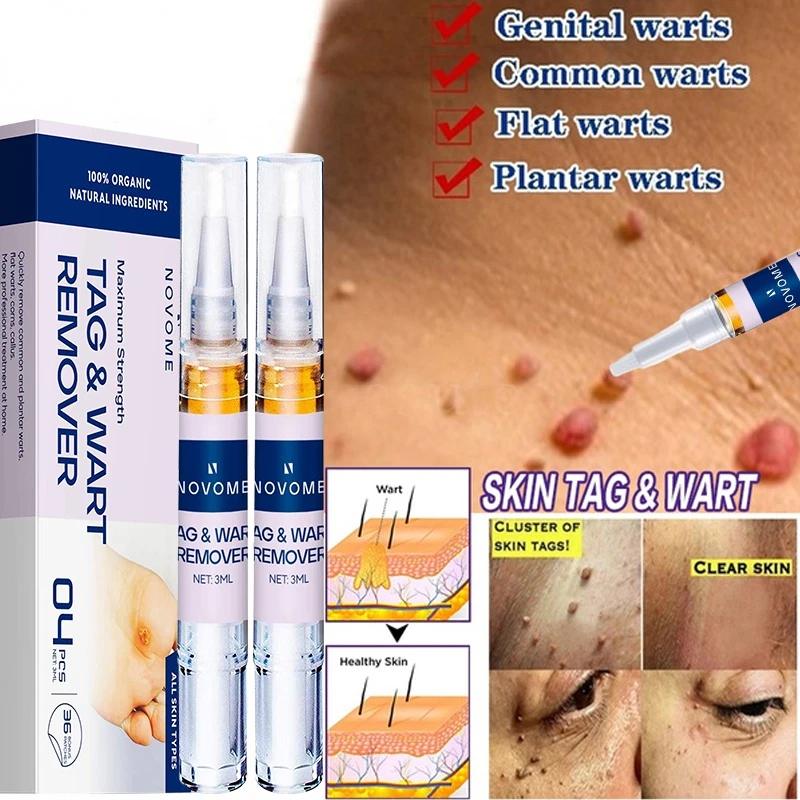 2022 Removing Against Moles Liquid Pen Treatment Papillomas Removal Of Warts Liquid From Skin Tags Remover Anti Verruca Remedy
2022 Removing Against Moles Liquid Pen Treatment Papillomas Removal Of Warts Liquid From Skin Tags Remover Anti Verruca Remedy
