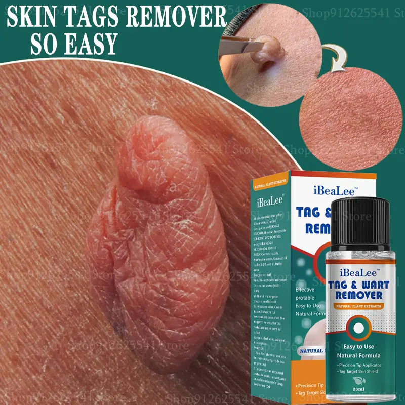 Herbal Skin Tags Remover Essential Oil Painless Mole Skin Dark Spot Warts Remover Serum Freckle Face Wart Tag Treatment
Herbal Skin Tags Remover Essential Oil Painless Mole Skin Dark Spot Warts Remover Serum Freckle Face Wart Tag Treatment