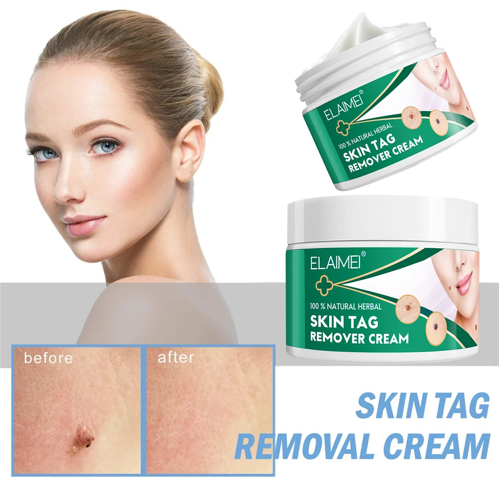 Fast Removal Skin Tag Remover Cream Natural Skin Tag Treatment Ointment Painless Face Body Wart Mole Corn Removal Face Skin Care
Fast Removal Skin Tag Remover Cream Natural Skin Tag Treatment Ointment Painless Face Body Wart Mole Corn Removal Face Skin Care