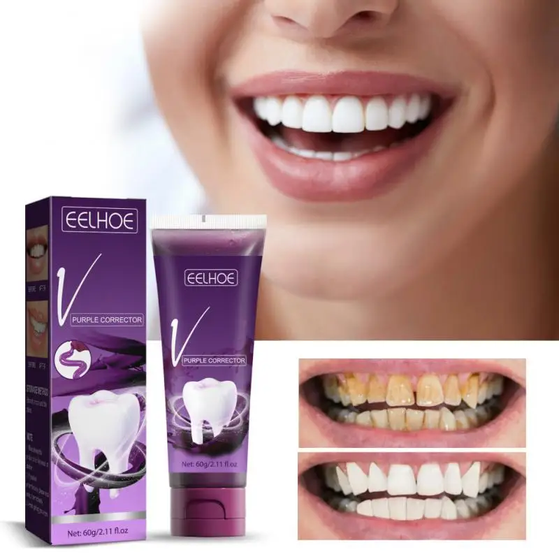 Whitening Toothpaste Essence Brightening Toothpaste To Remove Tartar Yellow Stain Smoke Stains Teeth Cleaning Oral Hygiene Tools
Whitening Toothpaste Essence Brightening Toothpaste To Remove Tartar Yellow Stain Smoke Stains Teeth Cleaning Oral Hygiene Tools