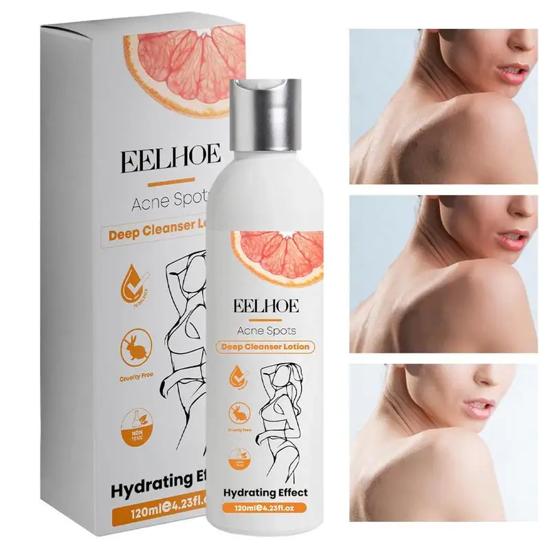 Body Whitening Cream For Women Underarm Knee Buttocks Private Bleach Remove Body Whitening Bleach Cream Body Whitening Cream 
Body Whitening Cream For Women Underarm Knee Buttocks Private Bleach Remove Body Whitening Bleach Cream Body Whitening Cream