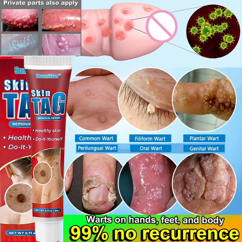 Мерный крем для безболезненной чистки кожи Кротов, темных пятен, женский крем-сыворотка для мужчин и женщин
Мерный крем для безболезненной чистки кожи Кротов, темных пятен, женский крем-сыворотка для мужчин и женщин