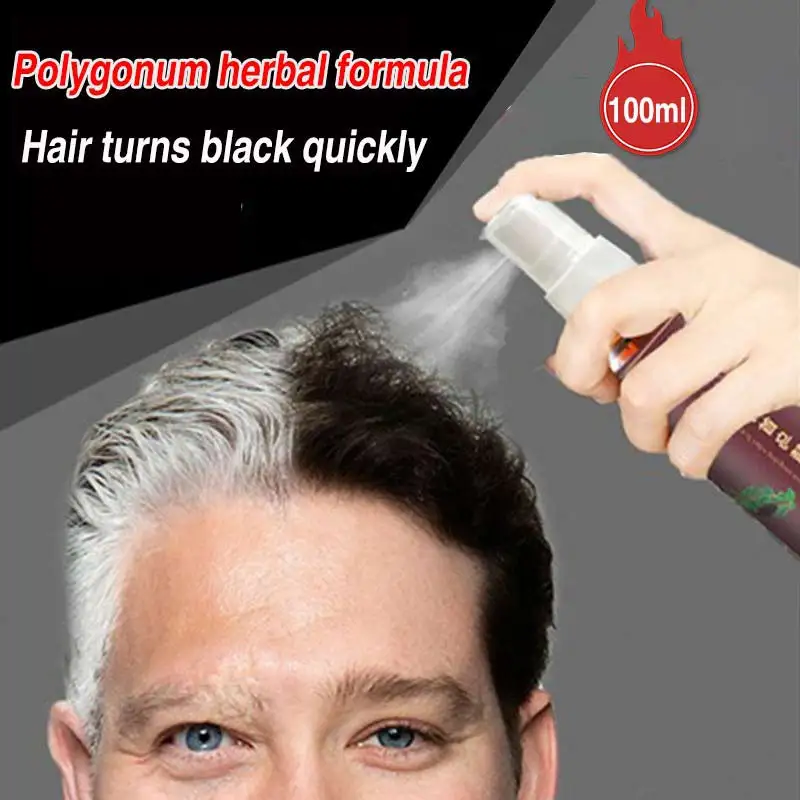 300/100ml Liquid Herbal Cure White Hair Treatment Spray Hair Growth Essence Oils Black Hair Oil Control Shampoo Hair Care
300/100ml Liquid Herbal Cure White Hair Treatment Spray Hair Growth Essence Oils Black Hair Oil Control Shampoo Hair Care