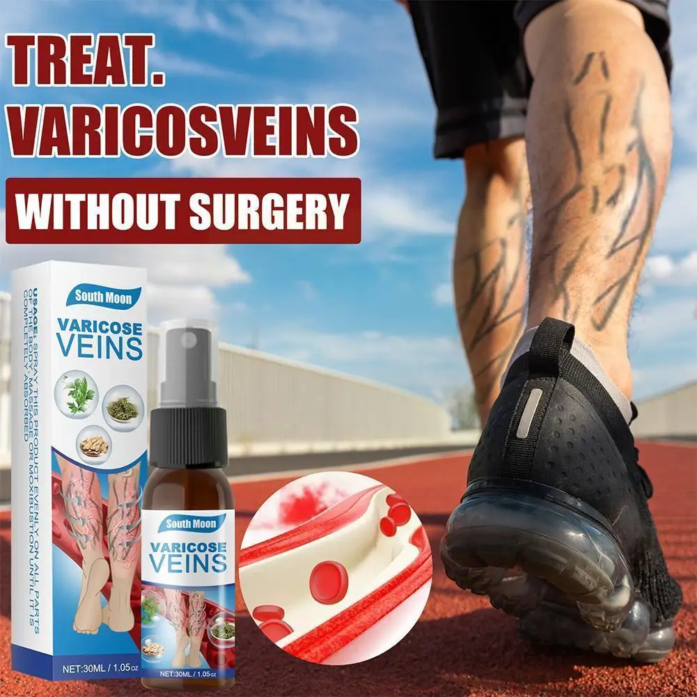 Varicose Veins spray Medicine Spider Veins Treatment Relief Care Spider Pain Plaster Vasculitis 30ml Medical Relief Phlebit L9J6 
Varicose Veins spray Medicine Spider Veins Treatment Relief Care Spider Pain Plaster Vasculitis 30ml Medical Relief Phlebit L9J6