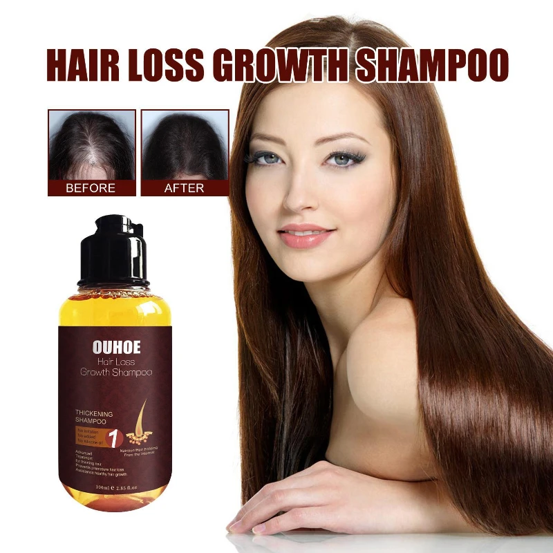 Anti-fall Solid Hair Cleansing Scalp Shampoo Dense Hair Shampoo Moisturizing Thick Hair Soft Hair
Anti-fall Solid Hair Cleansing Scalp Shampoo Dense Hair Shampoo Moisturizing Thick Hair Soft Hair