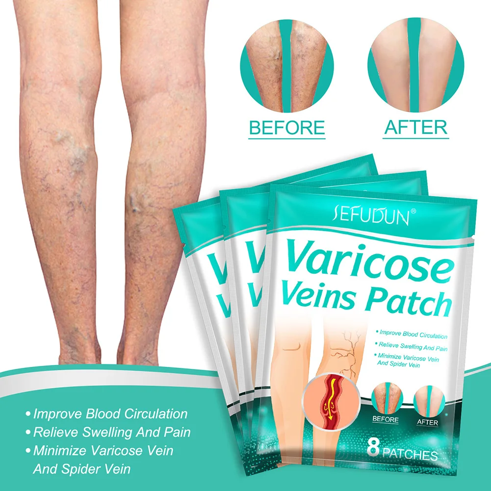 8 Patches Varicose Veins Patch Leg Pain Swelling Relief Plaster Spider Varicosity Angiitis Removal Phlebitis Treatment Patch
8 Patches Varicose Veins Patch Leg Pain Swelling Relief Plaster Spider Varicosity Angiitis Removal Phlebitis Treatment Patch