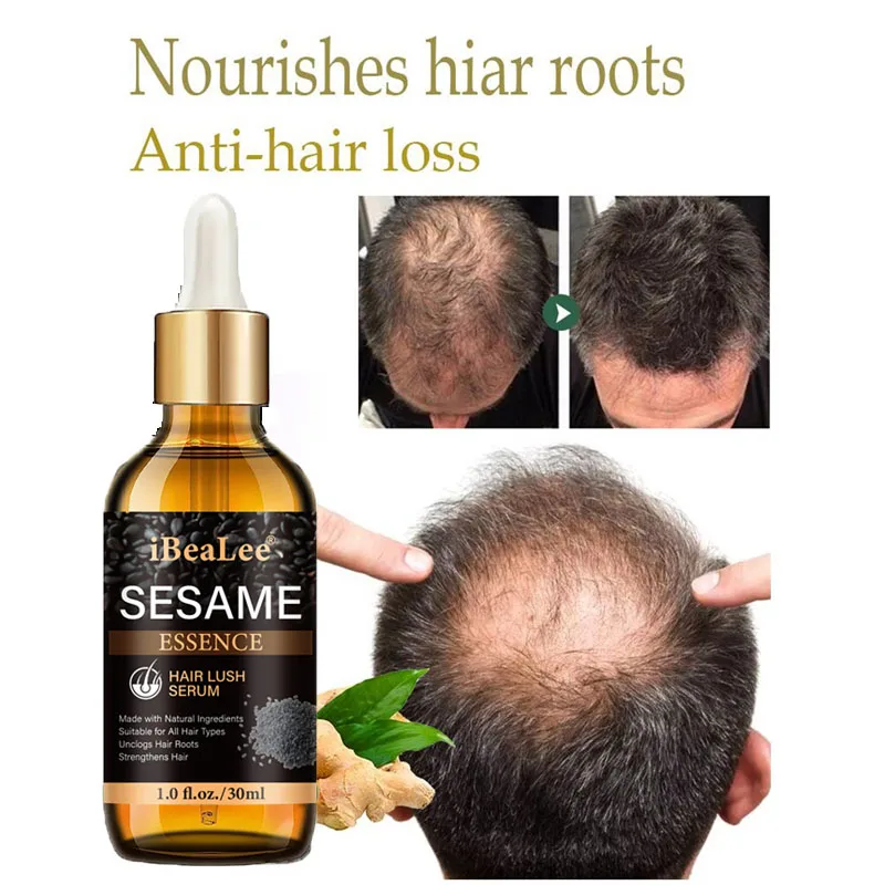 Ginger Fast Hair Growth Essential Oil Longer Fuller Thicker Moisturizing Nourishing Scalp Treatment Serum Care Products 30ml
Ginger Fast Hair Growth Essential Oil Longer Fuller Thicker Moisturizing Nourishing Scalp Treatment Serum Care Products 30ml