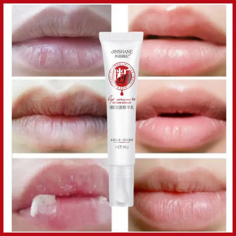

Lips Pink Cream Fresh Bleaching Treatment Remove Dark Smoke Lips Lip Balm Whitening Moisturizer Nourish Essence Dilute Melanin