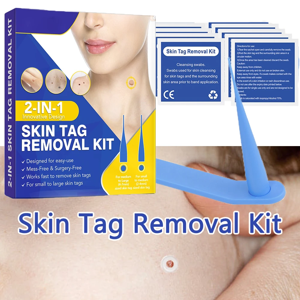 Skin Tag Removal Kit Eliminating Dark Moles On The Skin Care Tools For The Whole Body Wart Removal Patches Face Finishing Set
Skin Tag Removal Kit Eliminating Dark Moles On The Skin Care Tools For The Whole Body Wart Removal Patches Face Finishing Set