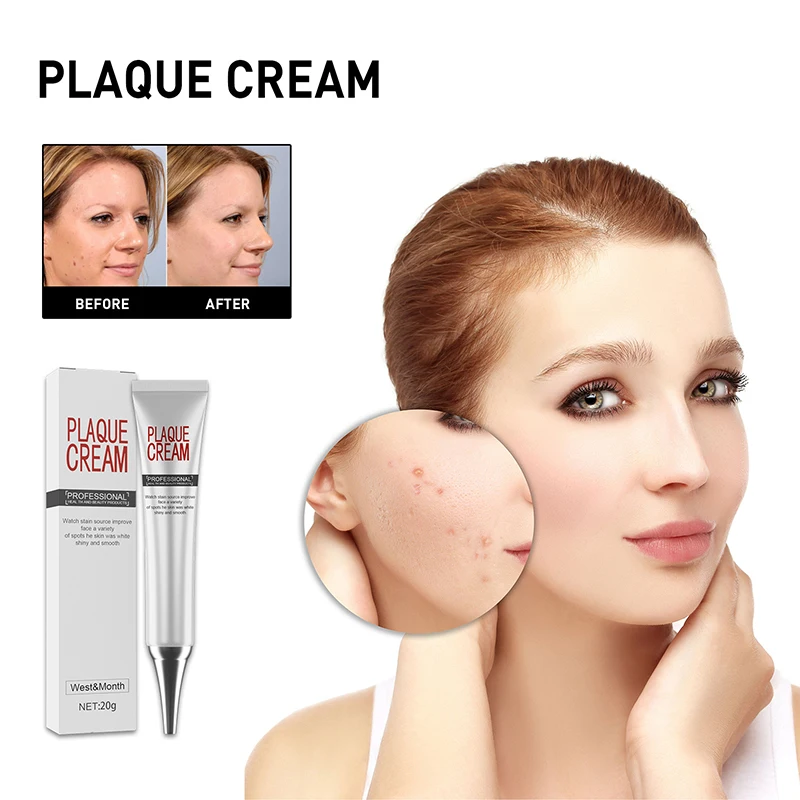 Отбеливающий крем для зубного налета 20 г, Увлажняющий Осветляющий крем, крем для веснушек, женский крем, корейский уход, новинка 2022
Отбеливающий крем для зубного налета 20 г, Увлажняющий Осветляющий крем, крем для веснушек, женский крем, корейский уход, новинка 2022