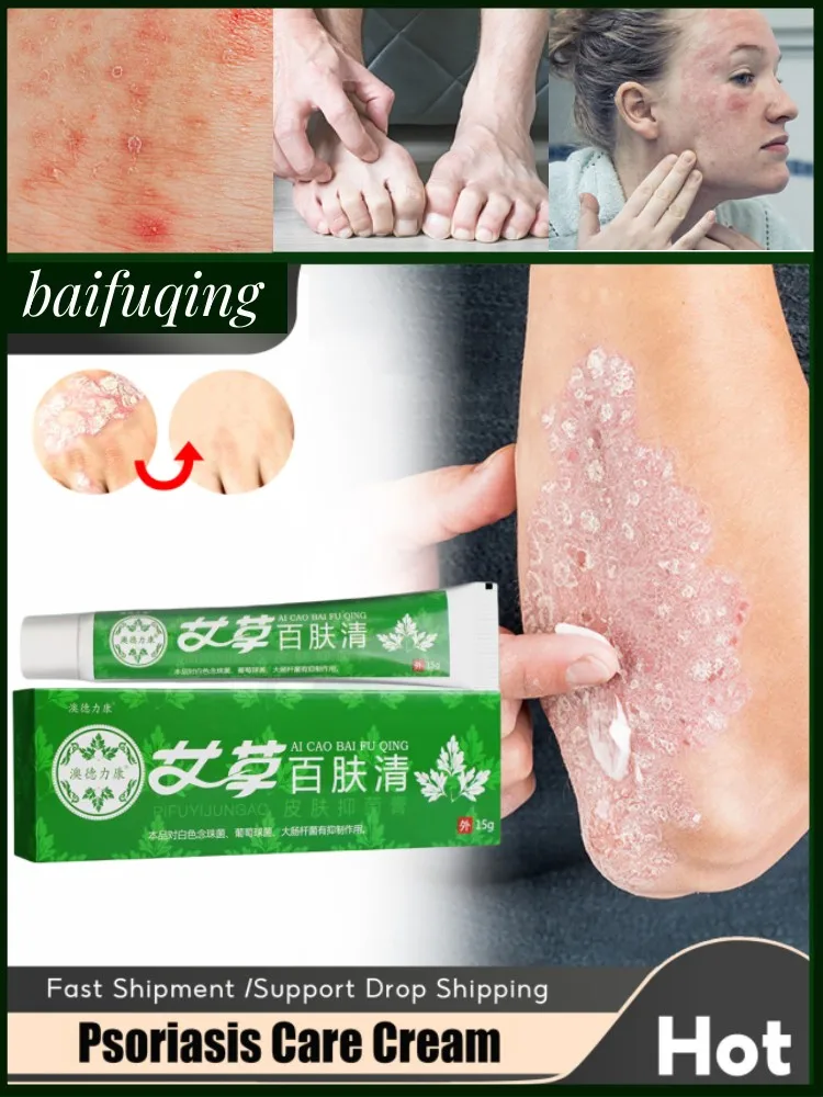 

Herbal Cure Psoriasis Anti-Bacterial Cream Treatment Eczema Dermatitis Ointment Anti-Itching Skin Problems Antifungal Cream S067