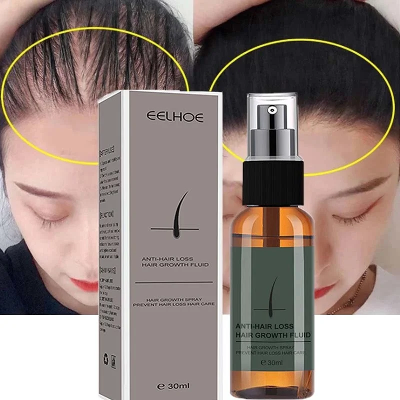 Ginger Hair Growth Products Anti-hair Loss Spray Serum Fast Grow Health Hair Essential Oil Repair Frizzy Damaged Thinning Care
Ginger Hair Growth Products Anti-hair Loss Spray Serum Fast Grow Health Hair Essential Oil Repair Frizzy Damaged Thinning Care
