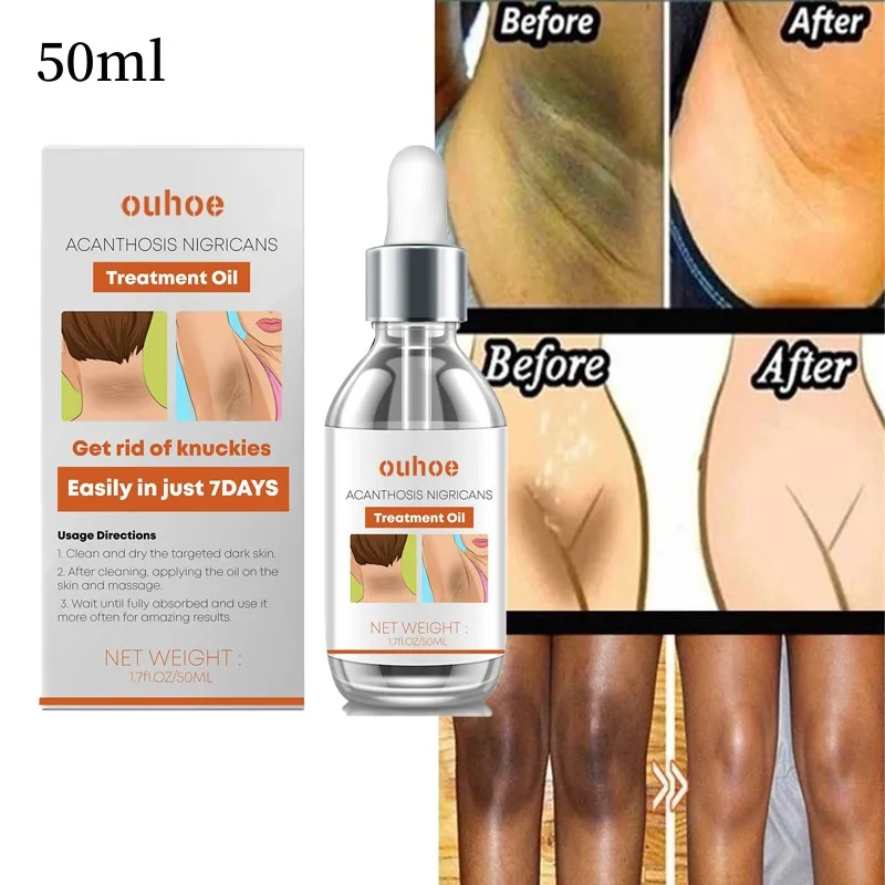 Whitening Body SerumWhitening Body SerumNipple Bleach Thigh Inner Remove Melanin Pigments Brighten Skin Care
Whitening Body SerumWhitening Body SerumNipple Bleach Thigh Inner Remove Melanin Pigments Brighten Skin Care
