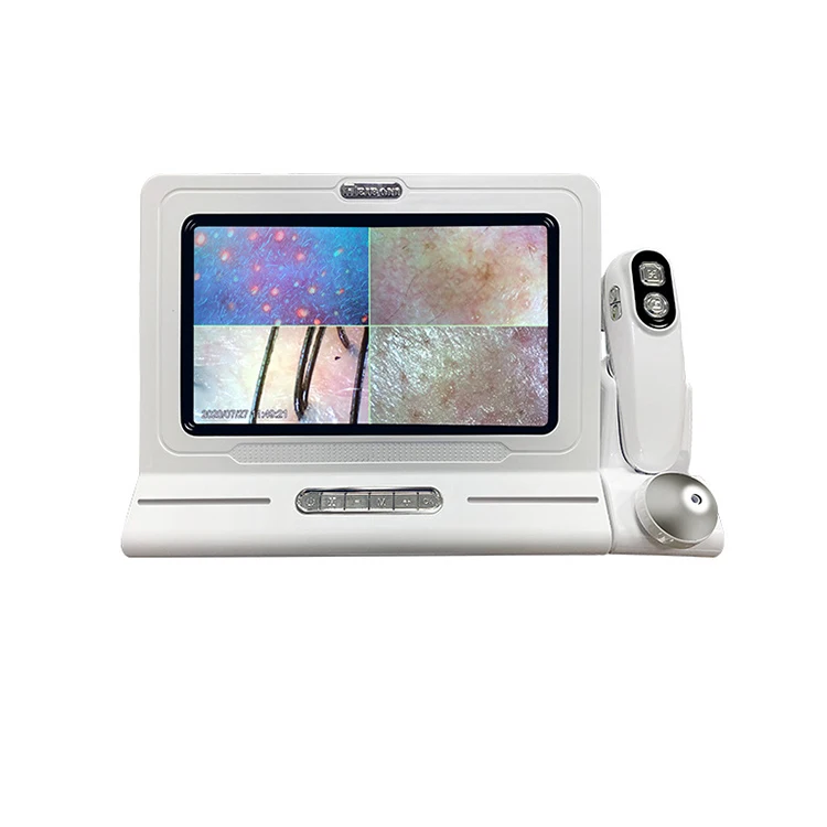 Top Quality Smart Skin And Hair Analyser Detector Multi-Function Skin Analyzer Hair Follicle Scalp Detector With 11 inch Screen 
Top Quality Smart Skin And Hair Analyser Detector Multi-Function Skin Analyzer Hair Follicle Scalp Detector With 11 inch Screen