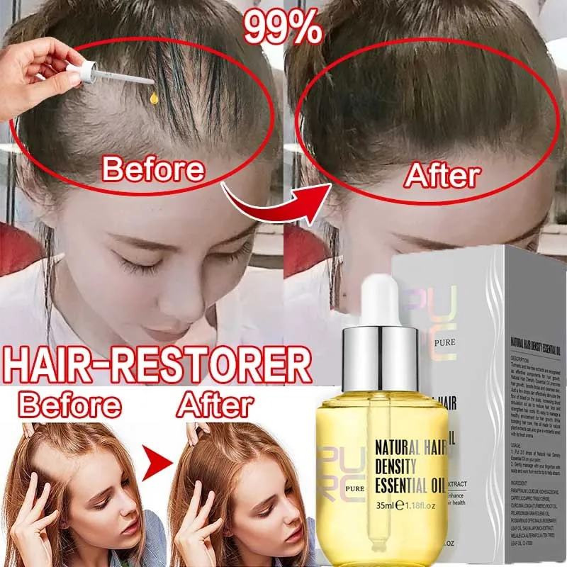PURC Ginger Essential Oil Hair Growth Serum Products For Men Women Fast Regrowth Hair Scalp Treatment Hair Grow Beauty Health
PURC Ginger Essential Oil Hair Growth Serum Products For Men Women Fast Regrowth Hair Scalp Treatment Hair Grow Beauty Health