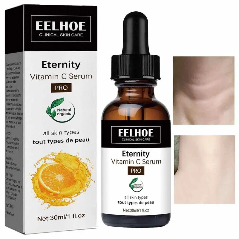 Лосьон с витамином C, эссенция для омоложения кожи, 1 унция, легко впитывает уход за кожей, восстанавливает кожу днем и ночью
Лосьон с витамином C, эссенция для омоложения кожи, 1 унция, легко впитывает уход за кожей, восстанавливает кожу днем и ночью