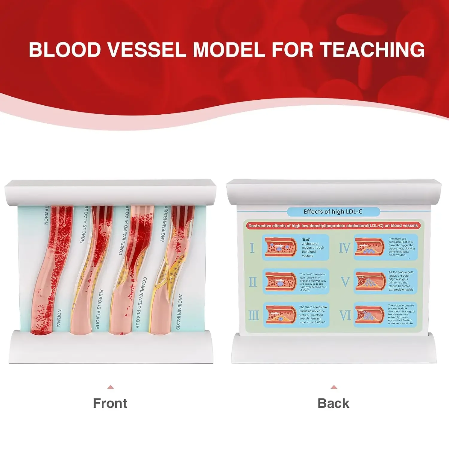 Модель кровеносного сосуда Four stage vascular state comparison model
Модель кровеносного сосуда Four stage vascular state comparison model