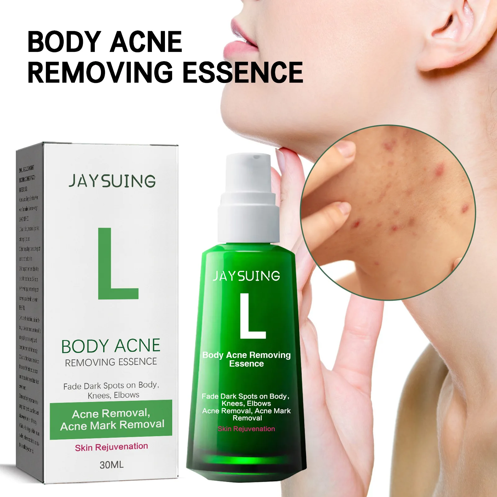 New Acne Remover Face Serum Herbs Acne Treatment Pimple Remover Shrink Pores Oil Control Face Herb Acne Skin Care 30ml
New Acne Remover Face Serum Herbs Acne Treatment Pimple Remover Shrink Pores Oil Control Face Herb Acne Skin Care 30ml