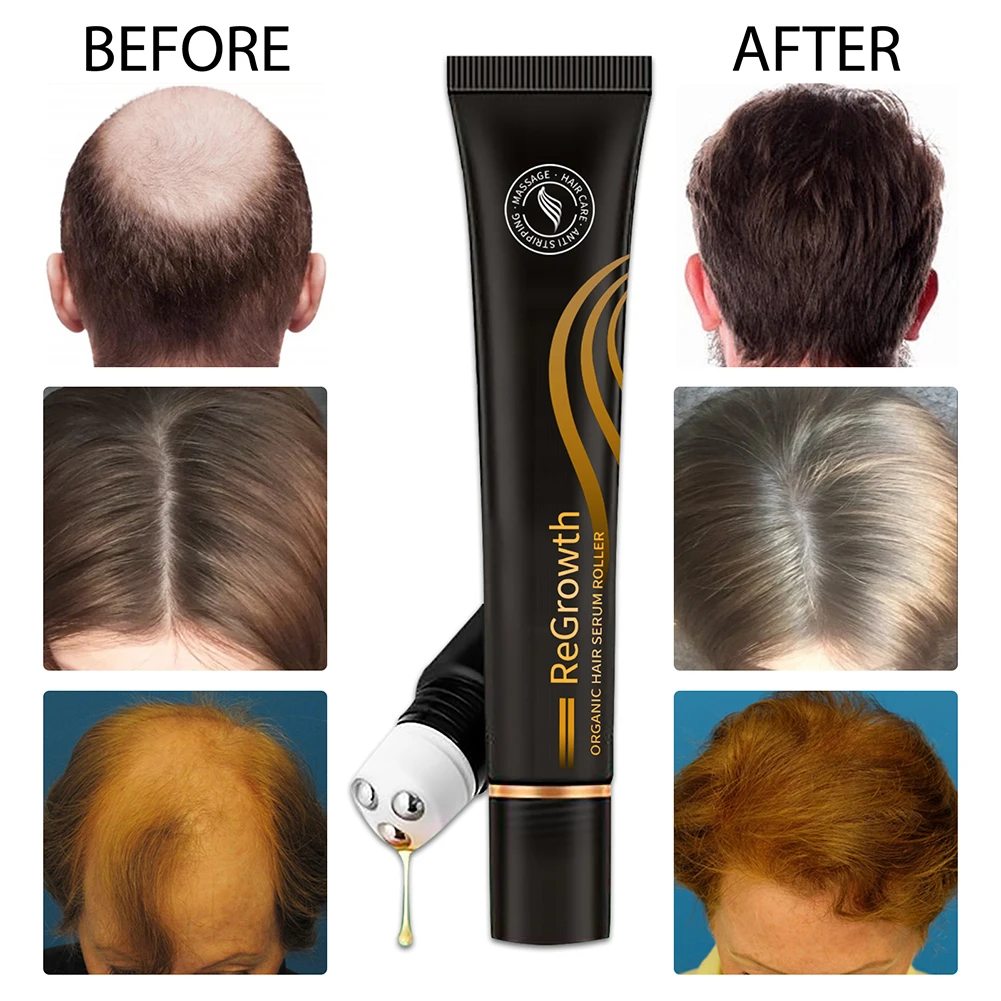 Regrowth Organic Hair Serum Roller Set Biotin Hair Growth Serum Triple Roll-On Massager Hair Growth Essence for All Hair Types
Regrowth Organic Hair Serum Roller Set Biotin Hair Growth Serum Triple Roll-On Massager Hair Growth Essence for All Hair Types
