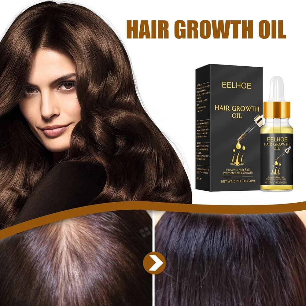 Effective Hair Growth Essential Oil Hair Loss Treatment Repair Dry Damaged Nourishes Follicles Restore Shine Smooth Beauty Care
Effective Hair Growth Essential Oil Hair Loss Treatment Repair Dry Damaged Nourishes Follicles Restore Shine Smooth Beauty Care